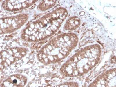 Immunohistochemistry-Paraffin: ACE/CD143 Antibody (ACE/3762) - Azide and BSA Free [NBP3-08557]