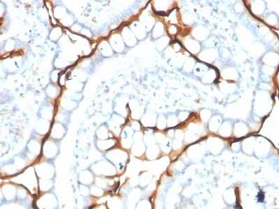 Immunohistochemistry-Paraffin: ACE/CD143 Antibody (ACE/3763) - Azide and BSA Free [NBP3-08558]
