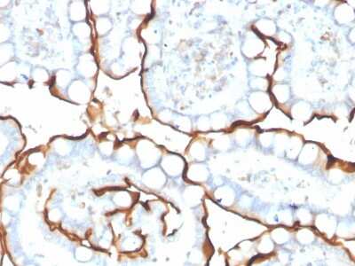 Immunohistochemistry-Paraffin: ACE/CD143 Antibody (ACE/3763) [NBP3-07608]