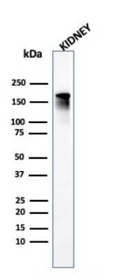 Western Blot: ACE/CD143 Antibody (ACE/3765)Azide and BSA Free [NBP3-08497]