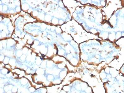 Immunohistochemistry-Paraffin: ACE/CD143 Antibody (ACE/3765) [NBP3-07780]