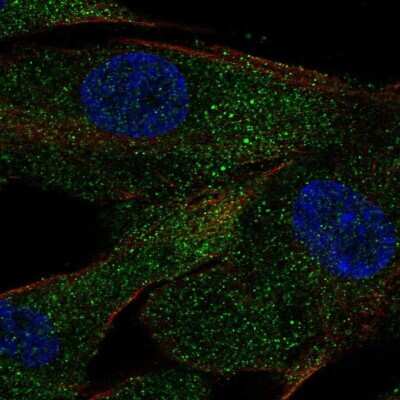 Immunocytochemistry/ Immunofluorescence: ACE/CD143 Antibody [NBP2-57207]