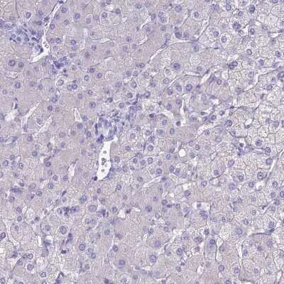 Immunohistochemistry-Paraffin: ACE/CD143 Antibody [NBP1-91666]