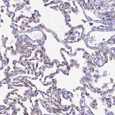 Immunohistochemistry-Paraffin: ACE/CD143 Antibody [NBP1-91666]
