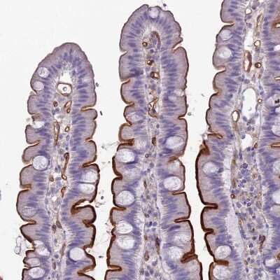 Immunohistochemistry-Paraffin: ACE/CD143 Antibody [NBP1-91666]