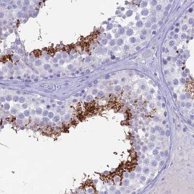 Immunohistochemistry-Paraffin: ACE/CD143 Antibody [NBP1-91666]