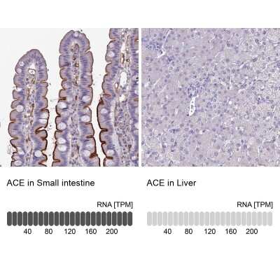 Immunohistochemistry-Paraffin: ACE/CD143 Antibody [NBP1-91666]
