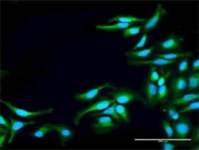Immunocytochemistry/ Immunofluorescence: ACK1 Antibody [H00010188-D01P]