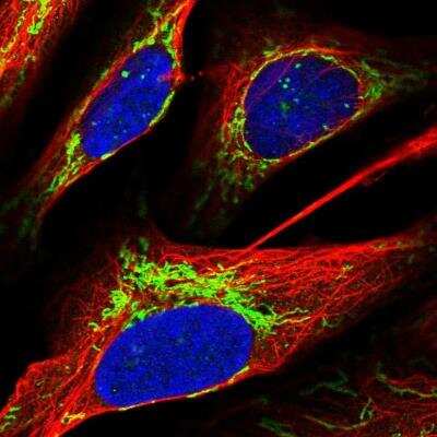 Immunocytochemistry/ Immunofluorescence: ACOT1 Antibody [NBP2-54709]