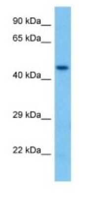 Western Blot: ACOT1 Antibody [NBP3-10843]