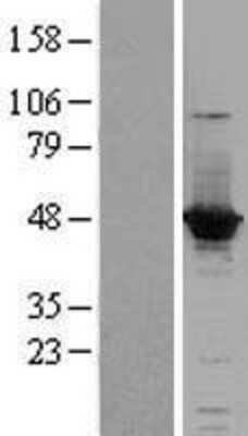 Western Blot: ACOT1 Overexpression Lysate [NBL1-07245]