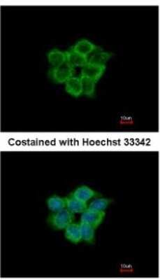 Immunocytochemistry/ Immunofluorescence: ACOT11 Antibody [NBP2-15246]
