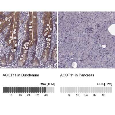 Immunohistochemistry-Paraffin: ACOT11 Antibody [NBP2-58936]