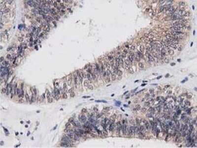 Immunohistochemistry: ACOT12 Antibody (OTI1A11) - Azide and BSA Free [NBP2-72389]