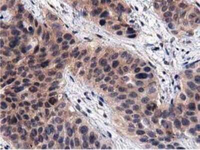 Immunohistochemistry: ACOT12 Antibody (OTI1A11) - Azide and BSA Free [NBP2-72389]