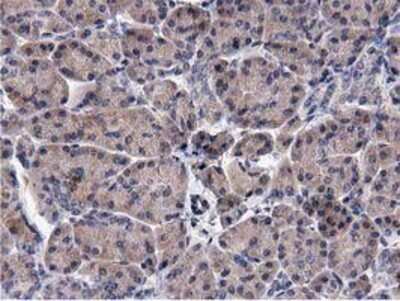 Immunohistochemistry: ACOT12 Antibody (OTI1A11) - Azide and BSA Free [NBP2-72389]