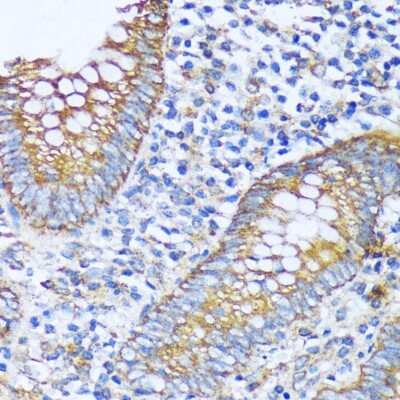 Immunohistochemistry-Paraffin: ACOT2 Antibody - Azide and BSA Free [NBP2-92161]