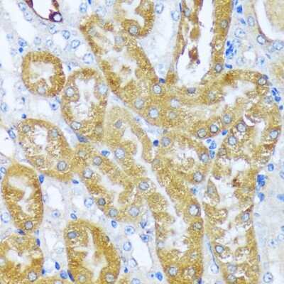 Immunohistochemistry-Paraffin: ACOT2 Antibody - Azide and BSA Free [NBP2-92161]