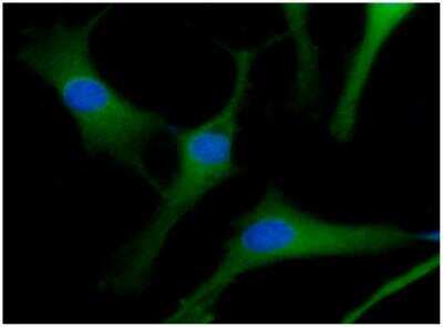 Immunocytochemistry/ Immunofluorescence: ACOT7 Antibody (1D5) - BSA Free [NBP2-22569]