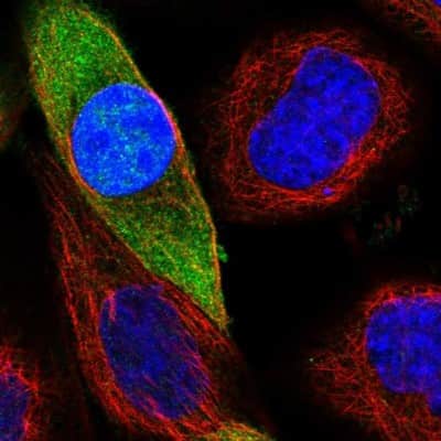 Immunocytochemistry/ Immunofluorescence: ACOT7 Antibody [NBP1-89278]