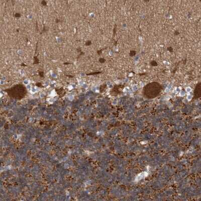 Immunohistochemistry-Paraffin: ACOT7 Antibody [NBP1-89278]