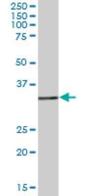 Western Blot: ACOT8 Antibody [H00010005-B01P]