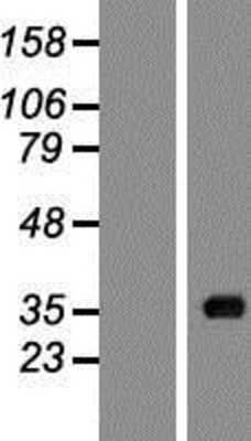 Western Blot: ACOT8 Overexpression Lysate [NBP2-07748]