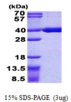 SDS-PAGE: Recombinant Human ACOT8 His Protein [NBP2-22676]