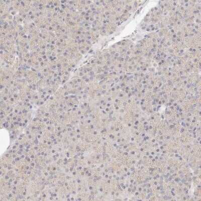 Immunohistochemistry-Paraffin: ACOX1 Antibody [NBP1-80949]