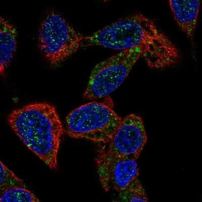 Immunocytochemistry/ Immunofluorescence: ACOX2 Antibody [NBP2-57292]