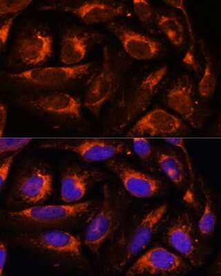 Immunocytochemistry/ Immunofluorescence: ACOX3 Antibody - Azide and BSA Free [NBP3-15513]