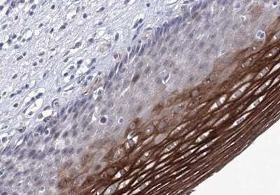 Immunohistochemistry-Paraffin: ACOX3 Antibody [NBP1-85900]