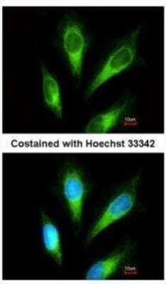 Immunocytochemistry/ Immunofluorescence: ACP2 Antibody [NBP2-15250]