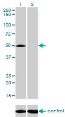 Western Blot: ACP2 Antibody (M1-4A12) [H00000053-M01]