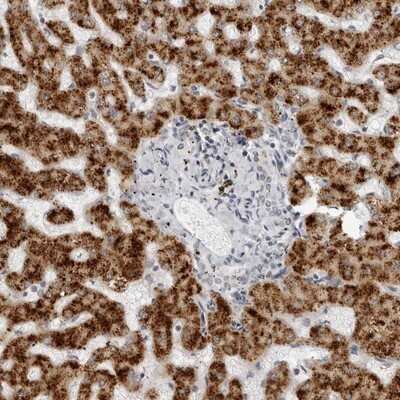 Immunohistochemistry-Paraffin: ACP6 Antibody [NBP1-89272]