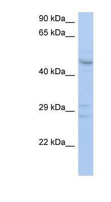Western Blot: ACPL2 Antibody [NBP1-59508]