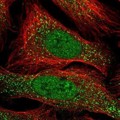 Immunocytochemistry/ Immunofluorescence: ACRBP Antibody [NBP1-85407]