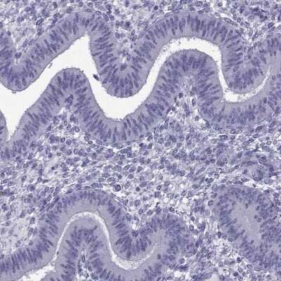 Immunohistochemistry-Paraffin: ACRBP Antibody [NBP1-85407]