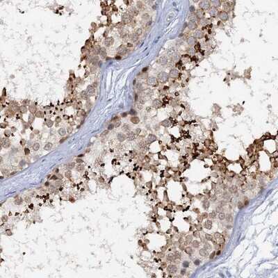 Immunohistochemistry-Paraffin: ACRBP Antibody [NBP1-85408]