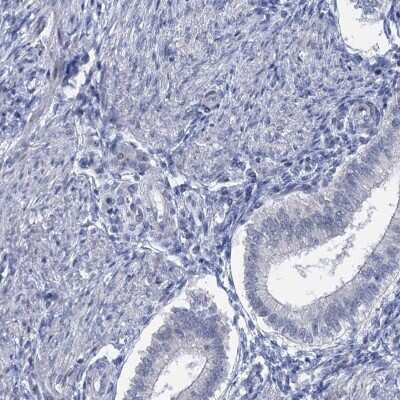 Immunohistochemistry-Paraffin: ACRBP Antibody [NBP1-85408]
