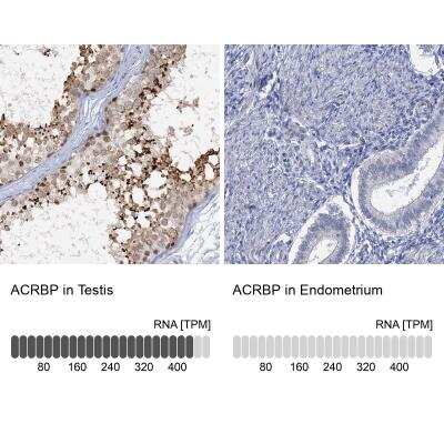 Immunohistochemistry-Paraffin: ACRBP Antibody [NBP1-85408]