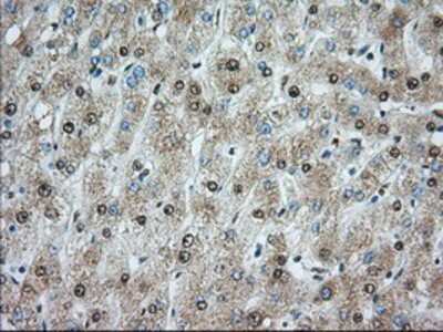 Immunohistochemistry-Paraffin: ACSBG1 Antibody (OTI1D8) [NBP2-02554]