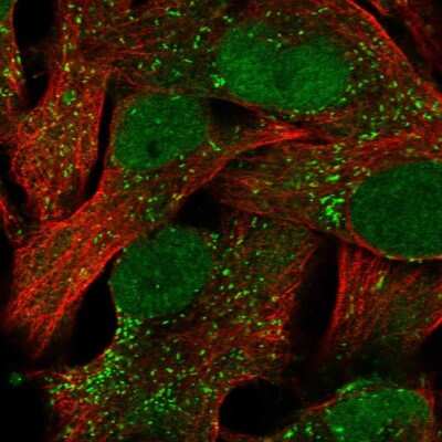 Immunocytochemistry/ Immunofluorescence: ACSBG1 Antibody [NBP2-58214]