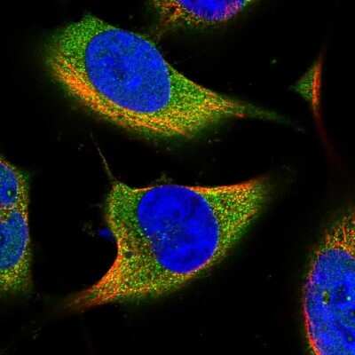 Immunocytochemistry/ Immunofluorescence: ACSBG2 Antibody [NBP1-88642]
