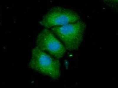 Immunocytochemistry/ Immunofluorescence: ACSF2 Antibody (18B4) - BSA Free [NBP2-59501]