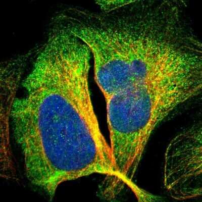 Immunocytochemistry/ Immunofluorescence: ACSF2 Antibody [NBP2-47558]