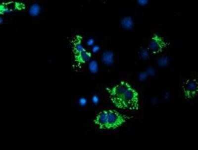Immunocytochemistry/ Immunofluorescence: ACSF2 Antibody (OTI6E4) - Azide and BSA Free [NBP2-72220]