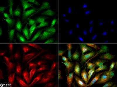 Immunocytochemistry/ Immunofluorescence: ACSL1 Antibody - BSA Free [NB110-99585]