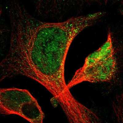 Immunocytochemistry/ Immunofluorescence: ACSL1 Antibody [NBP1-89271]