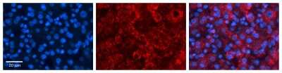Immunohistochemistry: ACSL1 Antibody [NBP1-60016]